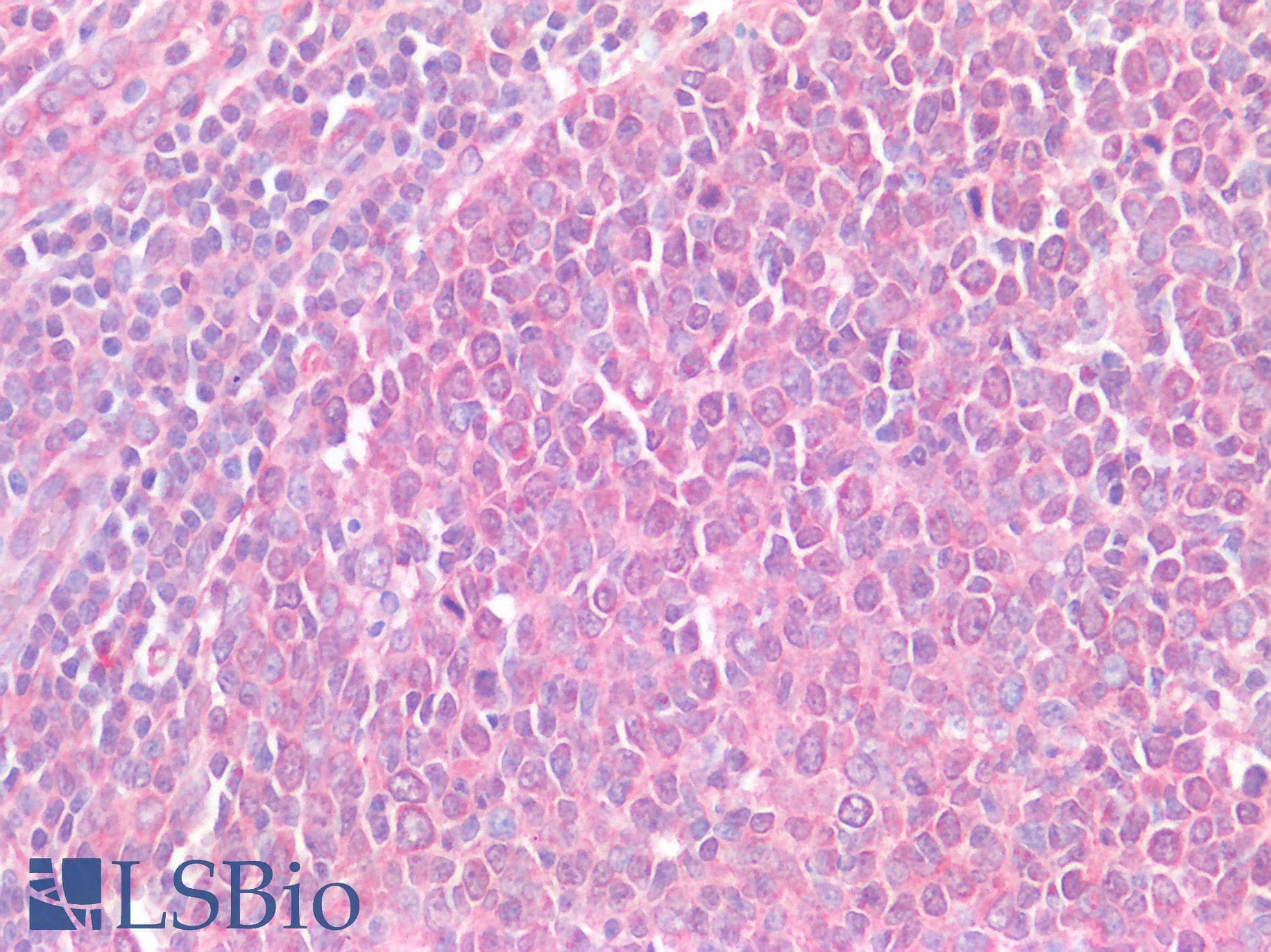 PathPlus™ Polyclonal Rabbit anti-Human CD274 / B7-H1 / PD-L1 Antibody (IHC)