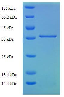 Human Complement C8g Protein (Recombinant His-SUMO)