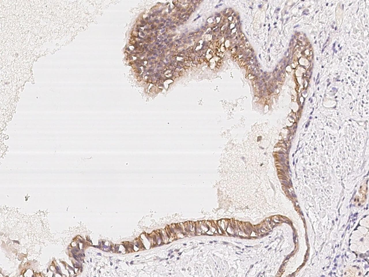 FAM206A / C9orf6 Antibody
