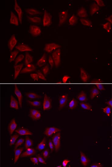 Polyclonal Rabbit anti-Human PDXK / PNK Antibody (IHC, IF, WB)