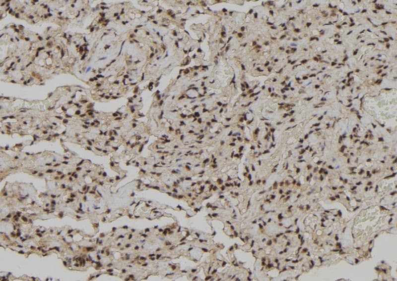 CEBPZ / CBF Antibody