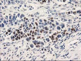UNG / Uracil DNA Glycosylase Antibody (clone OTI1A11)