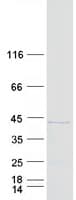 Human CCDC68 Protein (Recombinant Myc-DDK (Flag))