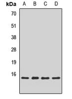 Polyclonal Rabbit anti-Human SNAPIN Antibody (WB)