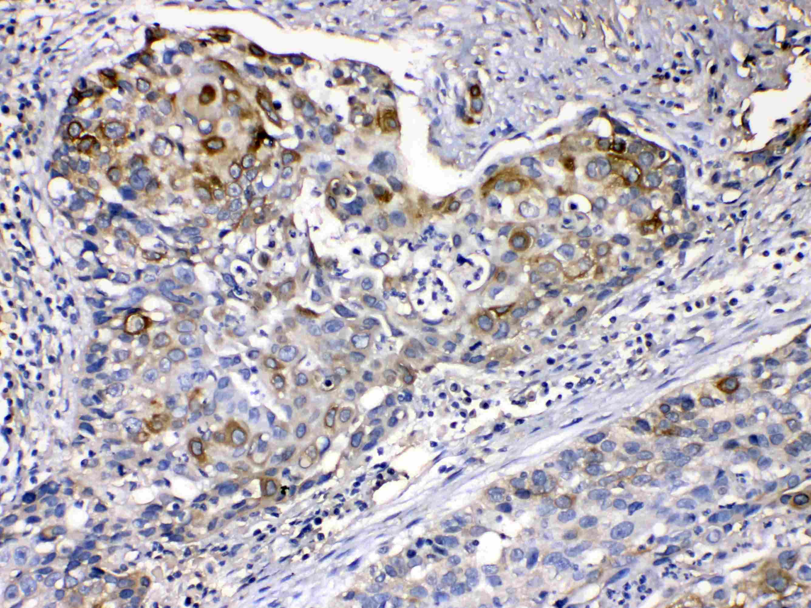KRT14 / CK14 / Cytokeratin 14 Antibody
