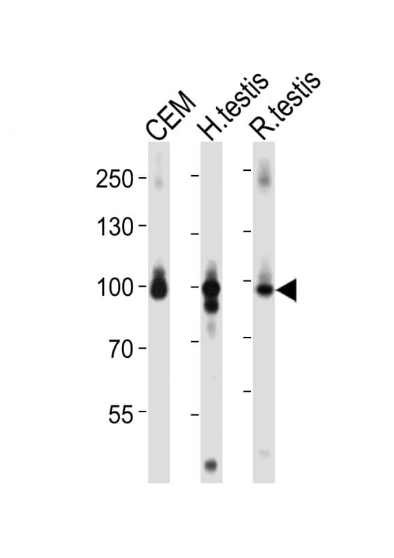 ACAP2 / Centaurin Beta 2 Antibody (aa764-798)