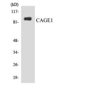 CAGE1 / Cancer Antigen 1 Antibody (aa704-753)