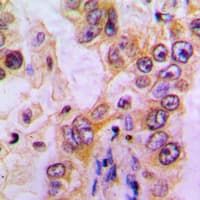 EHHADH / Enoyl-Coa Hydratase Antibody (Internal)