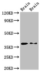 PEX10 Antibody