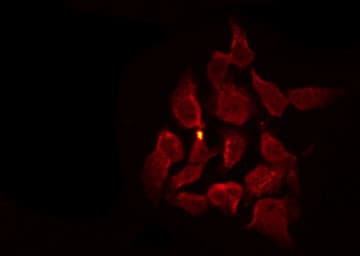 Polyclonal Rabbit anti-Human EGFR Antibody (phospho-Tyr1110, IF, WB)