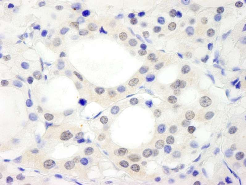 C17orf71 Antibody (aa250-300)