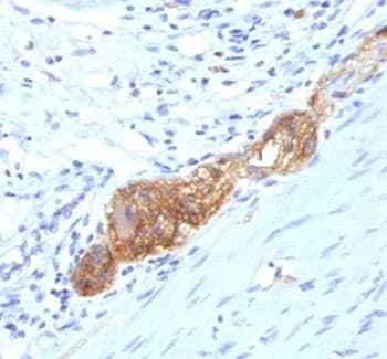 NCAM / CD56 Antibody (clone SPM489)
