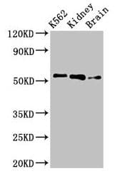 PFKFB2 Antibody