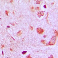Polyclonal Rabbit anti-Human POFUT1 Antibody (C-Terminus, IHC, IF, WB)