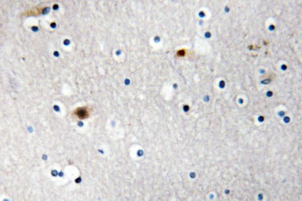 Polyclonal Rabbit anti-Human TAF1A Antibody (Arg318, IHC, WB)