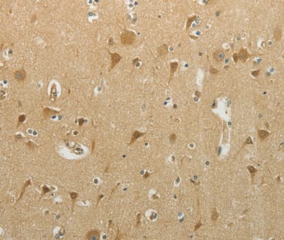 Polyclonal Rabbit anti-Human MCM4 Antibody (IHC, WB)