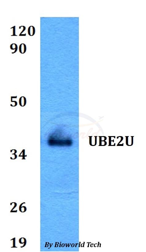 UBE2U Antibody