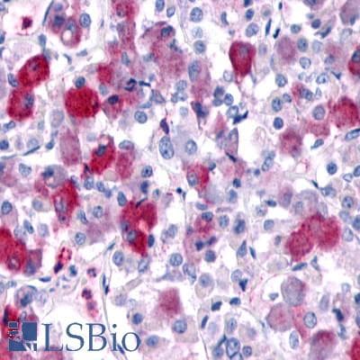 PathPlus™ GPR161 Antibody (N-Terminus)