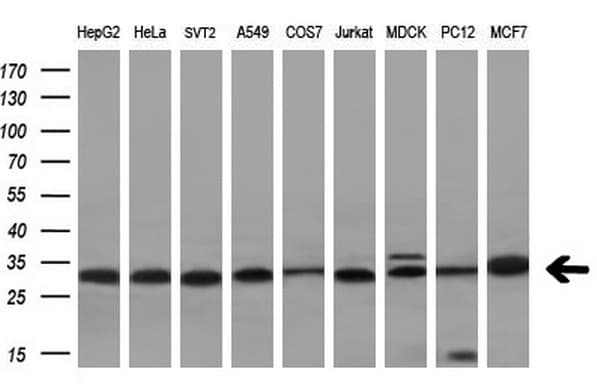 VAP33 / VAPA Antibody (aa2-227, clone OTI10E10)