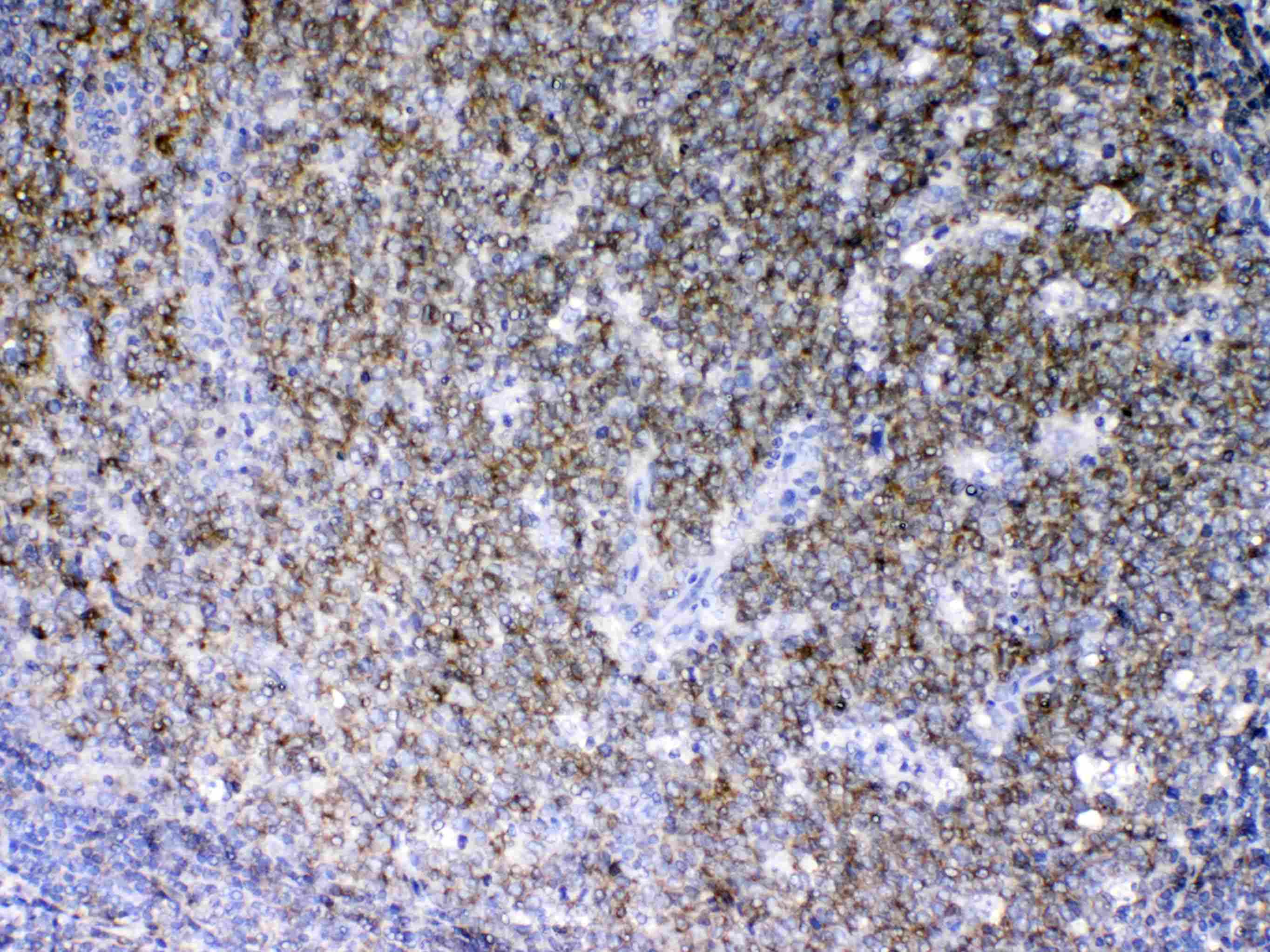 Polyclonal Rabbit anti-Human LYN Antibody (IHC, WB)
