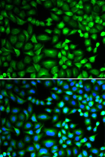 EIF5A Antibody
