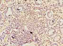 Polyclonal Rabbit anti-Rainbow trout TGFB1 / TGF Beta 1 Antibody (IHC, WB)