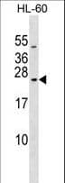 RAB20 Antibody (aa202-229)