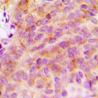 YWHAZ / 14-3-3 Zeta Antibody (C-Terminus)