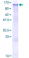 Human MCM4 Protein (Recombinant GST)