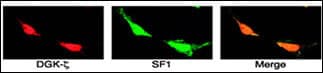 DGKZ Antibody (aa989-1019)