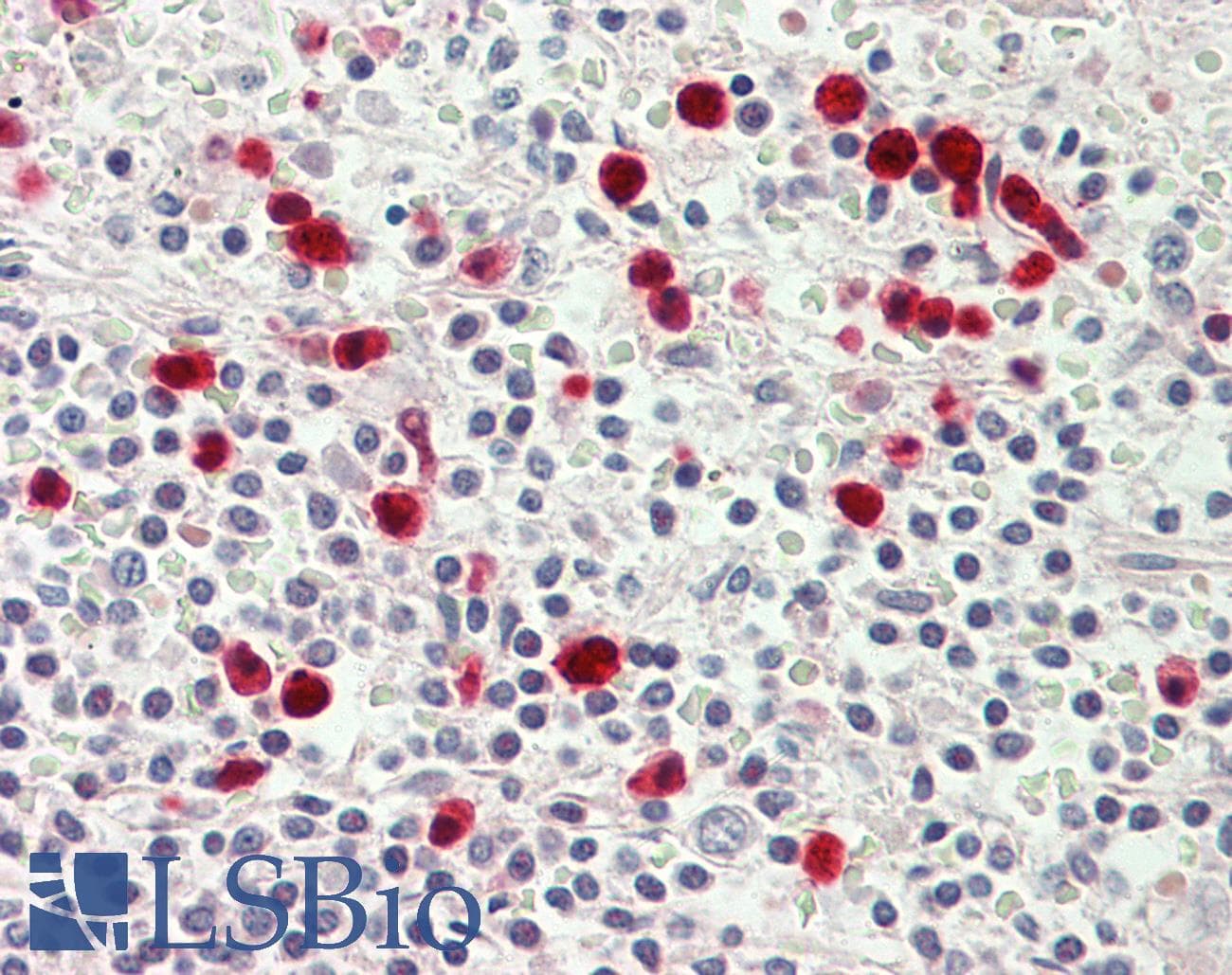 IHC-plus™ MYO1E / Myosin IE Antibody (aa228-257)