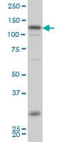 IHC-plus™ HIPK2 Antibody (clone 1F10)
