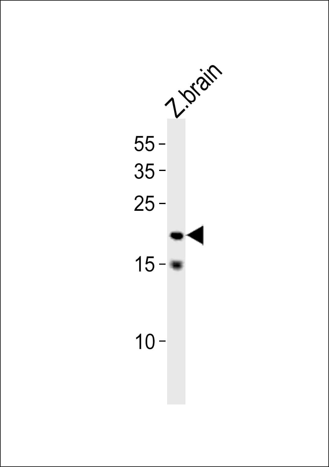 TCF21 / Epicardin Antibody (aa5-35)