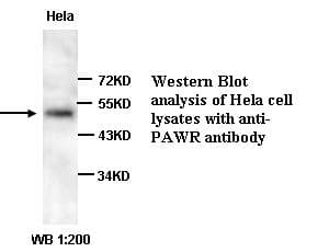 Polyclonal Rabbit anti-Human PAWR / PAR4 Antibody (IHC, WB)