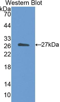 CETP Antibody (aa81-311, PE)