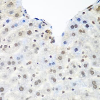 TDP-43 / TARDBP Antibody