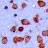 GPR119 Antibody (Internal)
