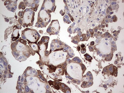 TFPI2 Antibody (aa23-235, clone OTI1G10)