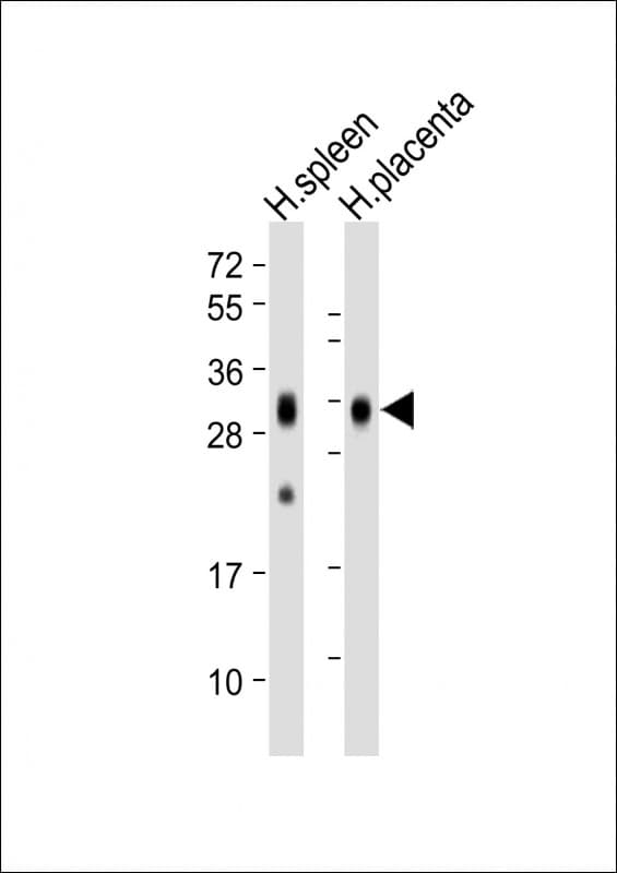 FBP / FOLR2 Antibody (clone 1905CT501.41.76)