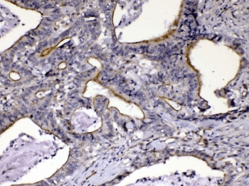 CCN3 / NOV Antibody