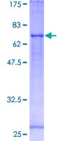Human FADS1 Protein (Recombinant GST)