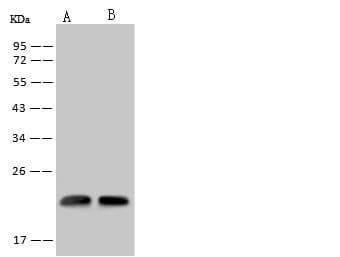 RWDD4A / RWDD4 Antibody
