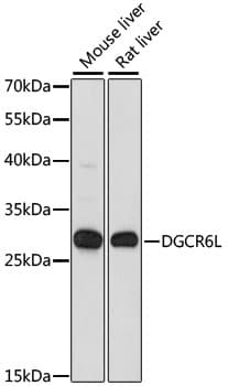 Polyclonal Rabbit anti-Human DGCR6L Antibody (WB)