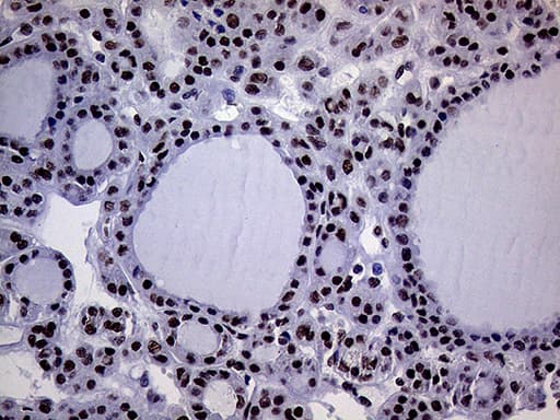RING1 Antibody (aa88-362, clone OTI3G7)