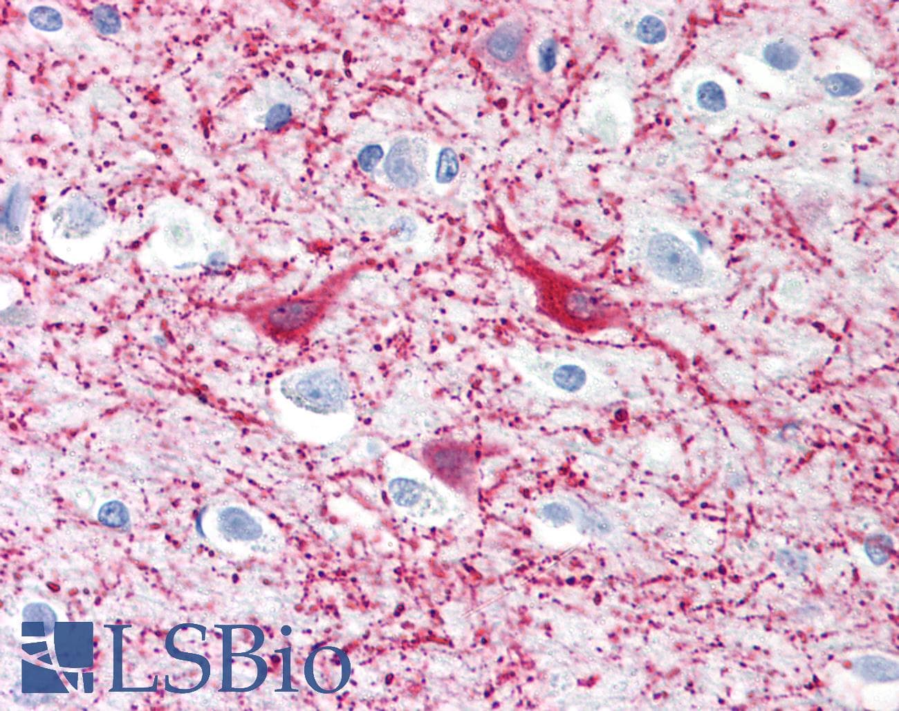 PathPlus™ MAP2 Antibody (clone MT-07)