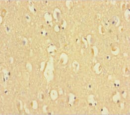 C9orf72 / ALSFTD Antibody