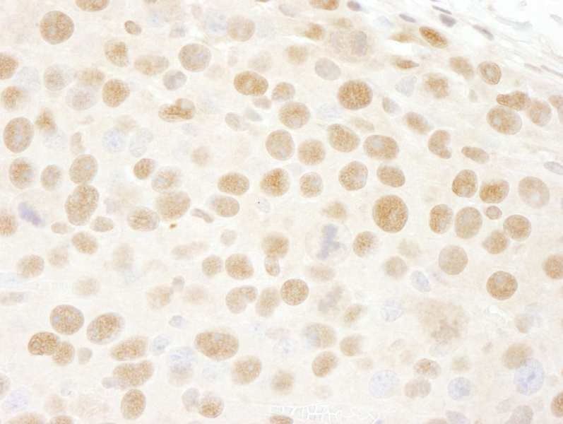 RBBP4 / RBAP48 Antibody (aa1-50)