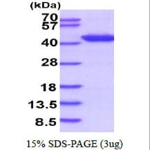 Human POLB / DNA Polymerase Beta Protein (Recombinant His)
