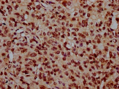 NDC1 / TMEM48 Antibody