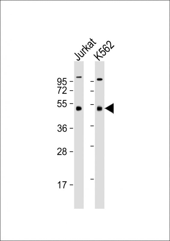 Monoclonal Mouse anti-Human MKRN2 Antibody (clone 1556CT631.230.55.49, WB)